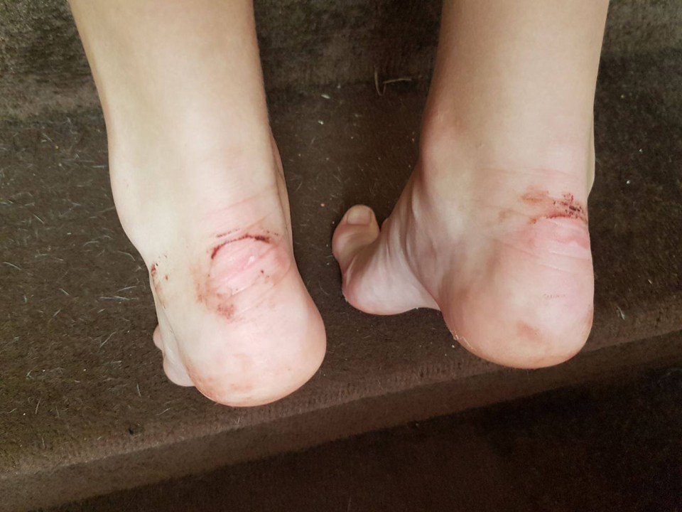 Lucy Wood, 11, made to take her socks off because they were white