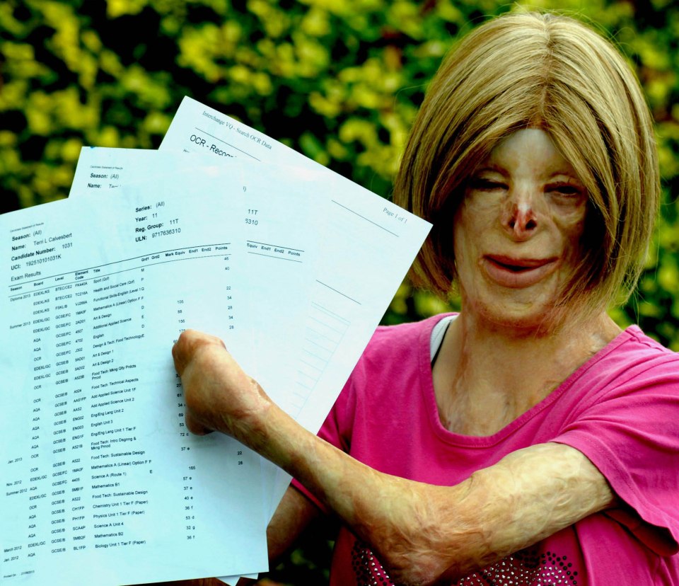 The teenager, pictured in 2013, is still trying to get the post removed from Facebook