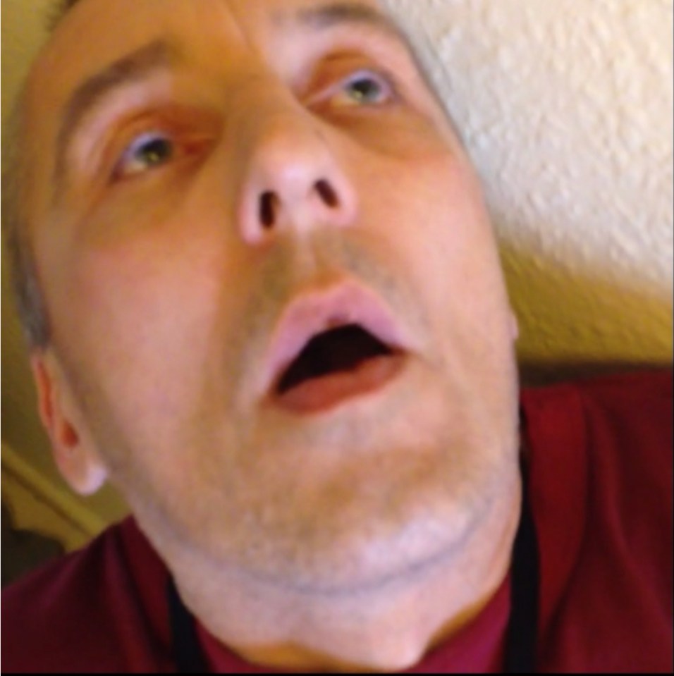 This lag is described as "dead" after taking so many drugs he can only stare blindly and cannot move