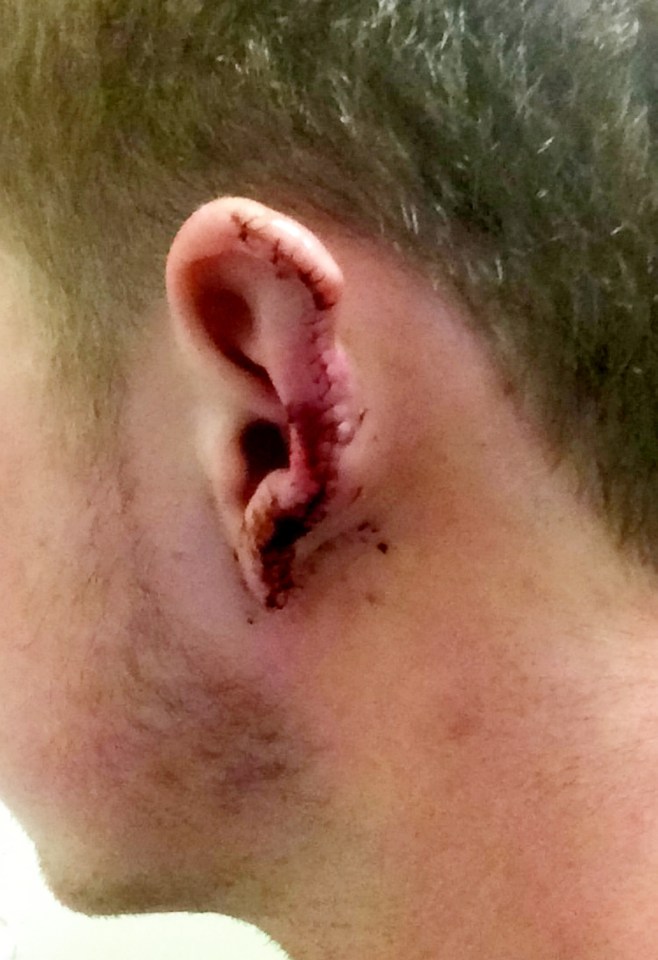 ear