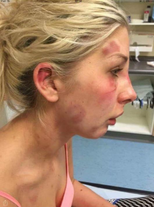 The graphic images have attracted huge attention online, with the young woman praised for her actions
