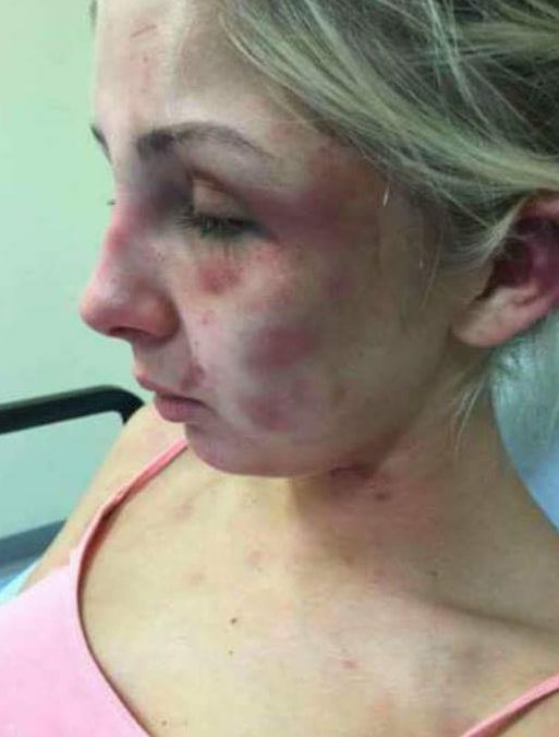 The young woman has been praised for bravely speaking out