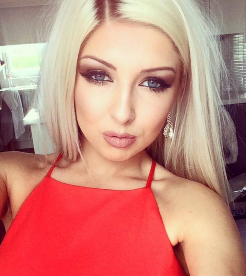 The young woman has been left permanently scarred from the attack