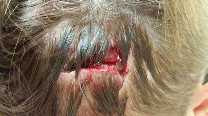 Owen was rushed to hospital by his concerned dad, with the 17-year-old undergoing a CT scan to ensure the attack had not done any internal damage