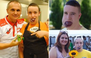 Teen with a tongue the size of TENNIS BALL bids to raise £47k for life saving op