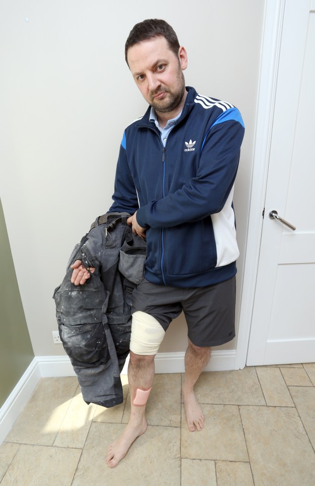 Plumber Carmelo Antinoro age 40 from Maidenhead had severe burns to his right leg after an electronic vape cigarette exploded in his right trouser pocket