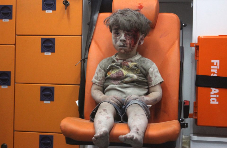 This child is believed to have been hurt by an airstrike launched by Russia or the Moscow-backed Syrian regime