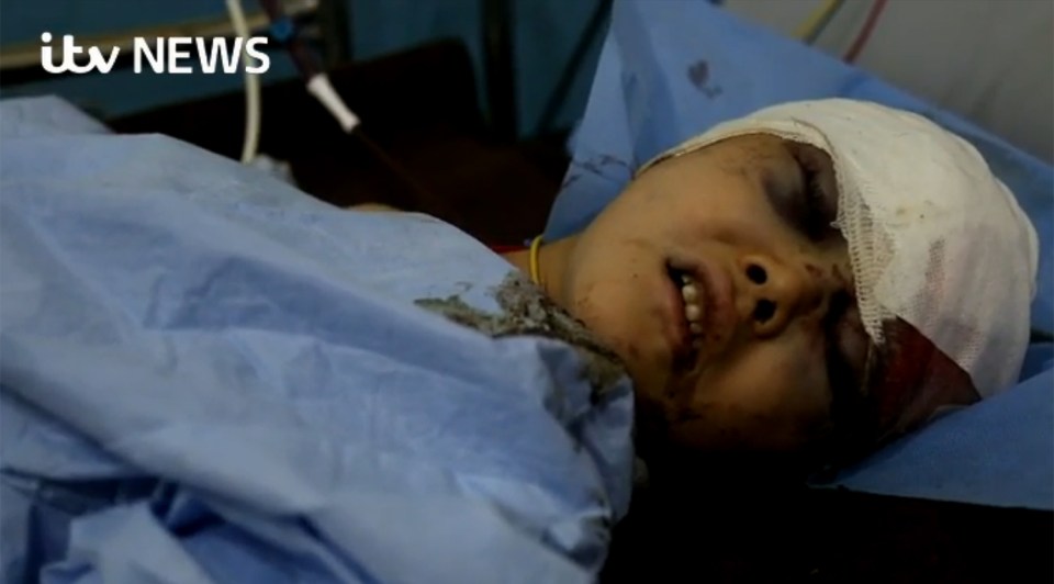 The tragic tot, four, died on Monday after suffering horrific wounds from the sickening weapon