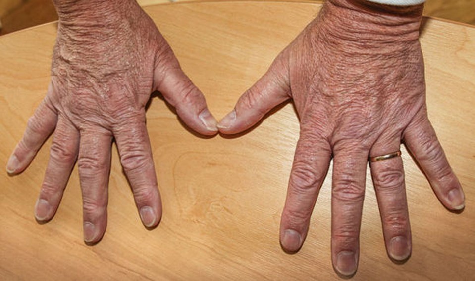 Mr Hookem released pictures of his hands in order to prove he didn't hit Mr Woolfe