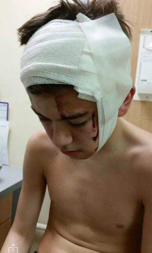 Owen Russell was left covered in blood after a clown threw a sharp stick at his group of friends, hitting him in the head