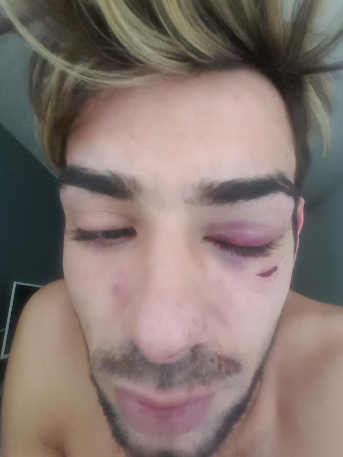Ryan has been left unable to work and open his eye properly following the terrifying attack