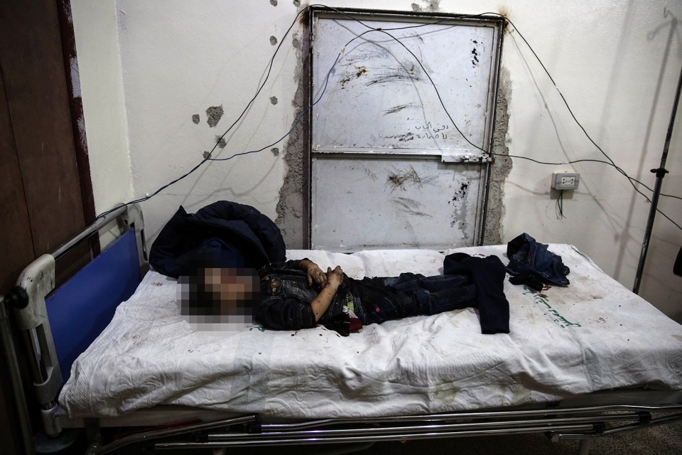 The body of a Syrian girl lies on a bed at a makeshift hospital following reported shelling on a kindergarten