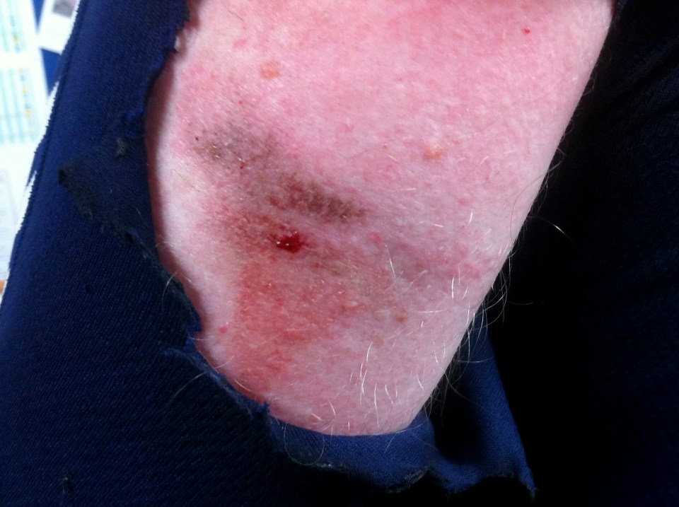 The Oxford computer science don told of his shock after the firework hit the back of his arm