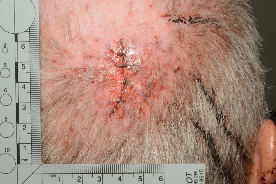 The jury were shown images of a head injury sustained by Thomas Mair during his arrest 