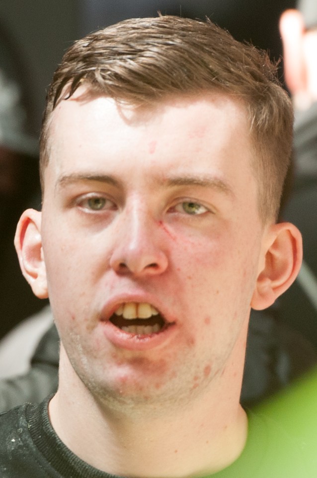 Zack Davies was jailed last year for a racially motivated attack on an Asian dentist