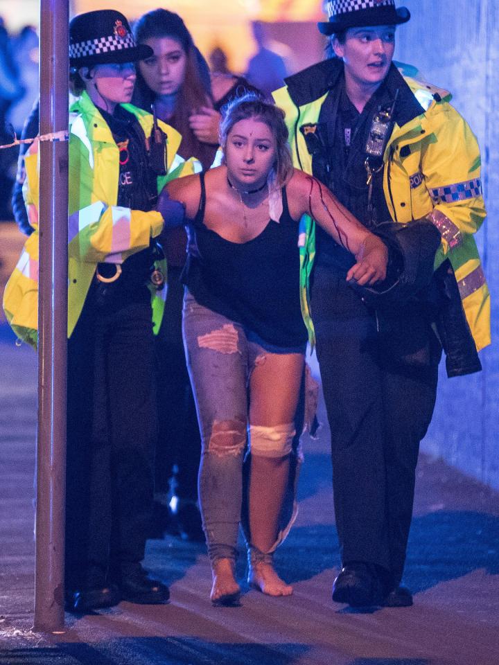 An injured woman is escorted from the arena by police after loud bangs were heard at the gig