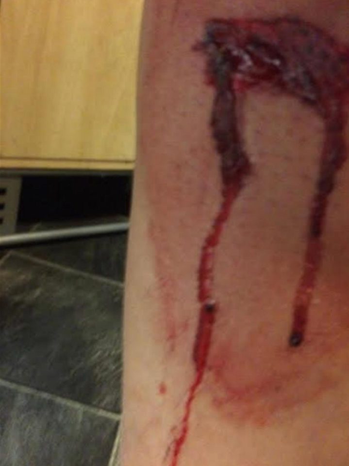 Another picture shows a deep gash across Lizzies legs
