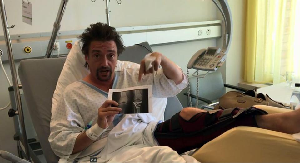 The Grand Tour presenter recovers in hospital following the smash