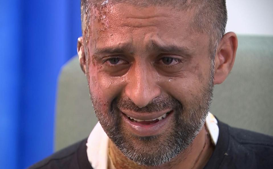 Jameel Muhktar suffered burns to his face