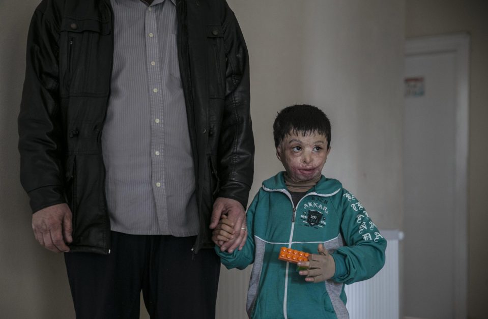 His family took him to Turkey due to the lack of medicine and healthcare in Syria