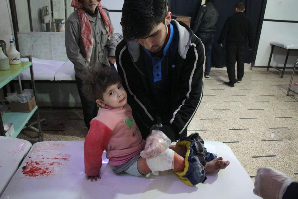 A wounded Syrian girl receives treatment at a make-shift hospital following reported air strikes on the rebel-held besieged town of Douma