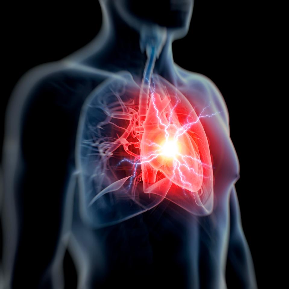 Cold weather can cause a spike in heart attacks and stroke