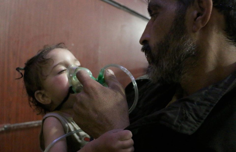  A child is treated after the alleged chemical attack. Many images are too harrowing to show