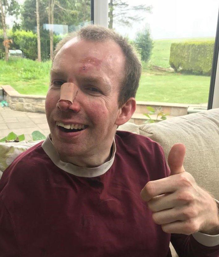 lee had a tumble before the Britain's Got Talent Final