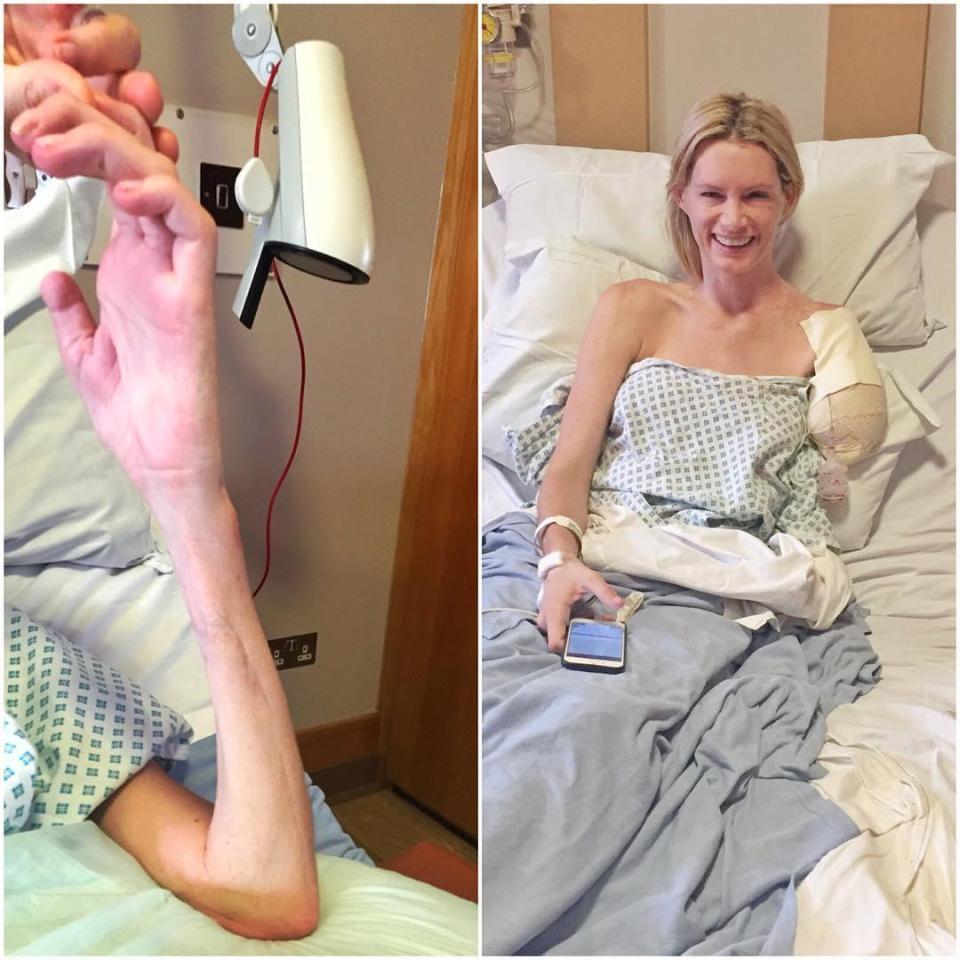  Half of Olivia's face was torn off and her left arm had to be amputated after the horror smash