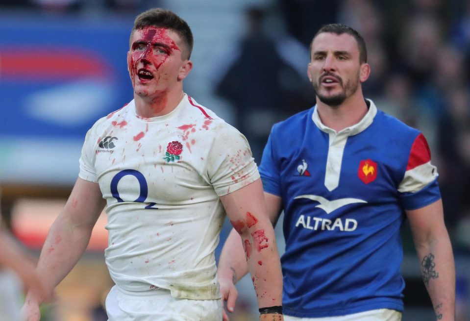 Flanker Tom Curry was well enough to come back on after this injury following five minutes of treatment 