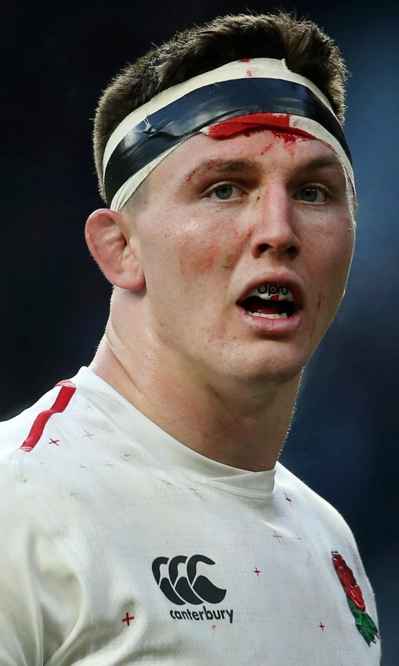 Red Rose hero Tom curry was patched up and returned, seemingly unshaken