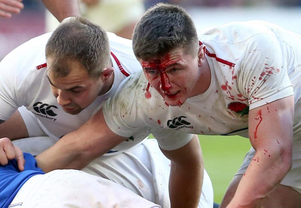Tom Curry was not afraid to get his head stuck in - even before he was treated 