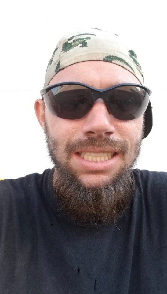  John Finlay now has new teeth