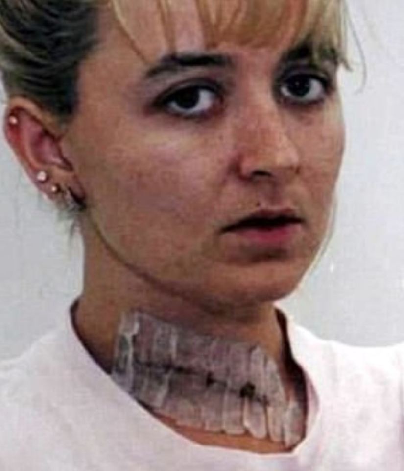 Darlie was left with a huge scar to her neck - which prosecutors insisted was self-inflicted