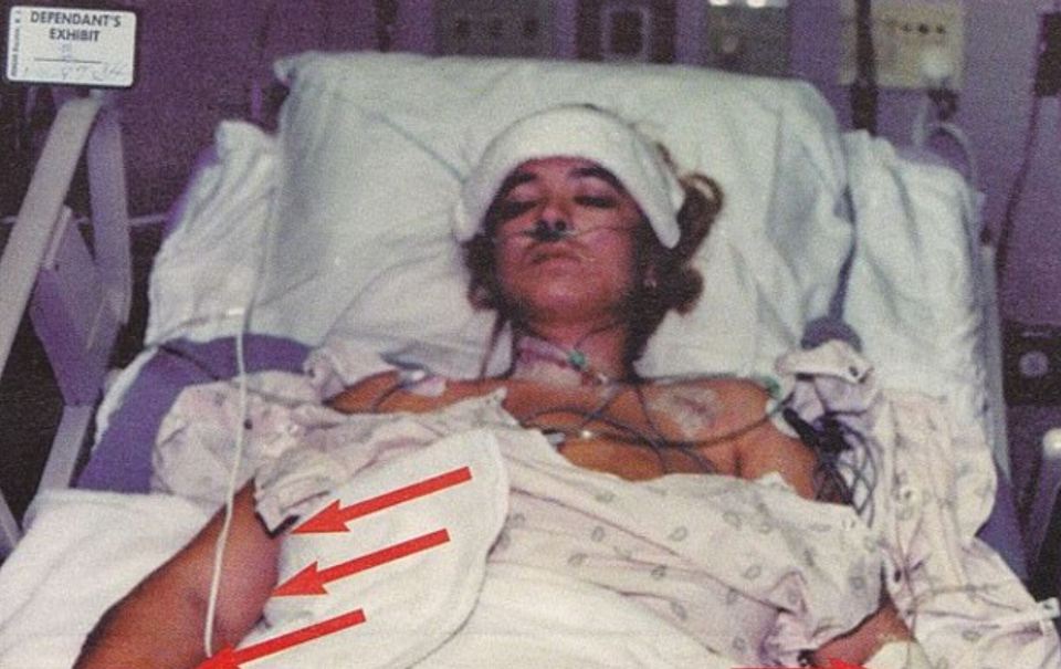 Darlie claims she was also attacked by an unknown intruder - pictured in hospital afterwards