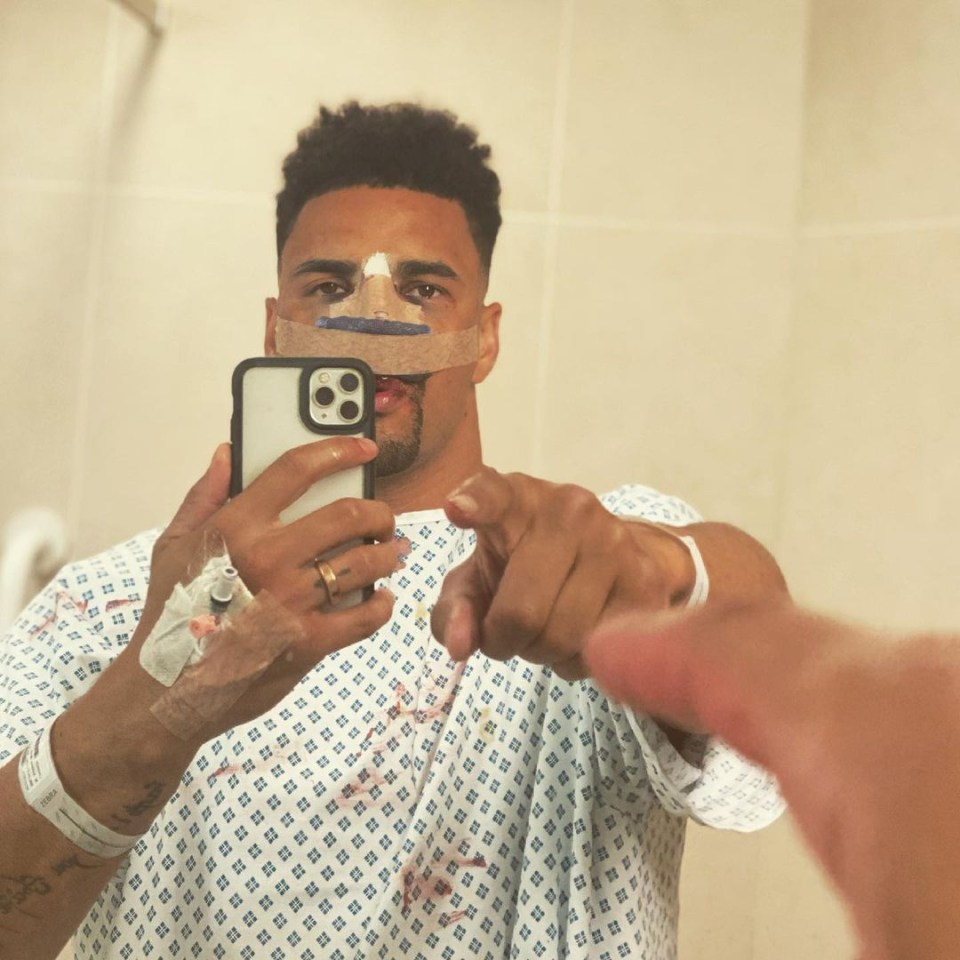 Anthony Ogogo underwent his tenth eye surgery and will be sidelined for a while