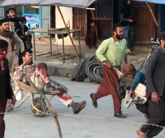 Bloodied victims were rushed to hospital in wheelbarrows after the airport explosion