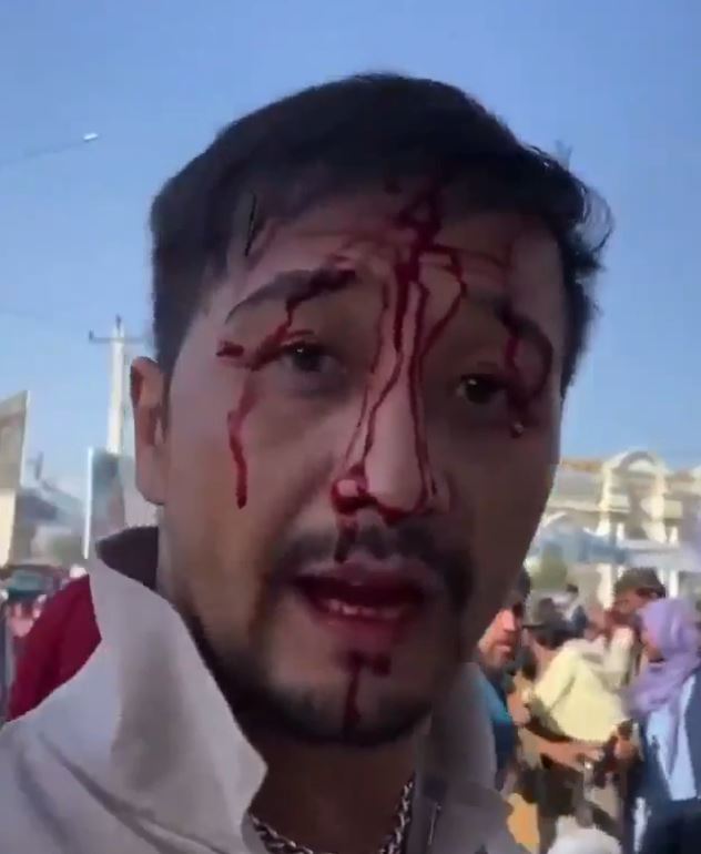 Video shows the Australian man after he was beaten by the Taliban