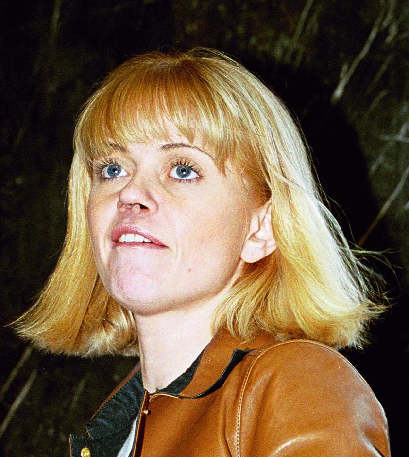Her septum famously collapsed while a drug addict on EastEnders