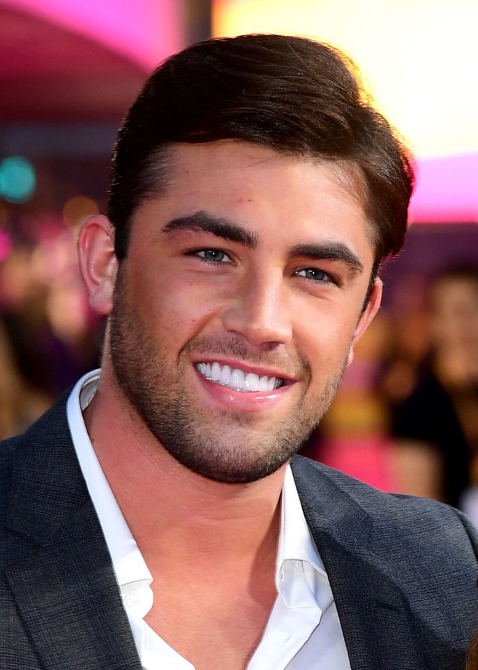 Jack's front tooth cracked when he was on Love Island
