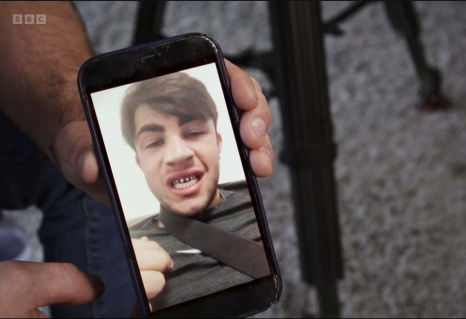 He's now shown off what his teeth looked like when they were filed down