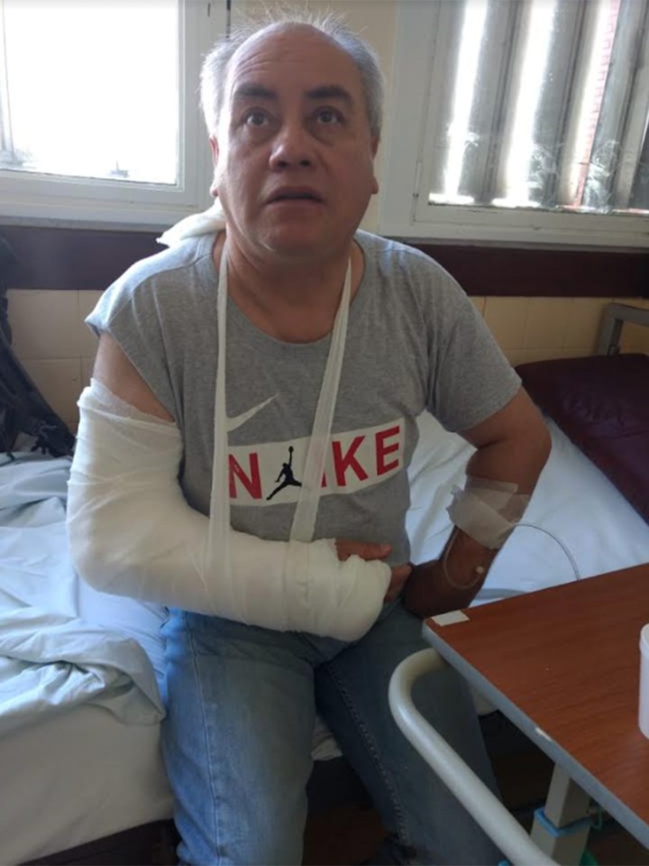 Photographer Pedro Alberto Orquera was left with a broken arm while lying bleeding on the floor following a street brawl