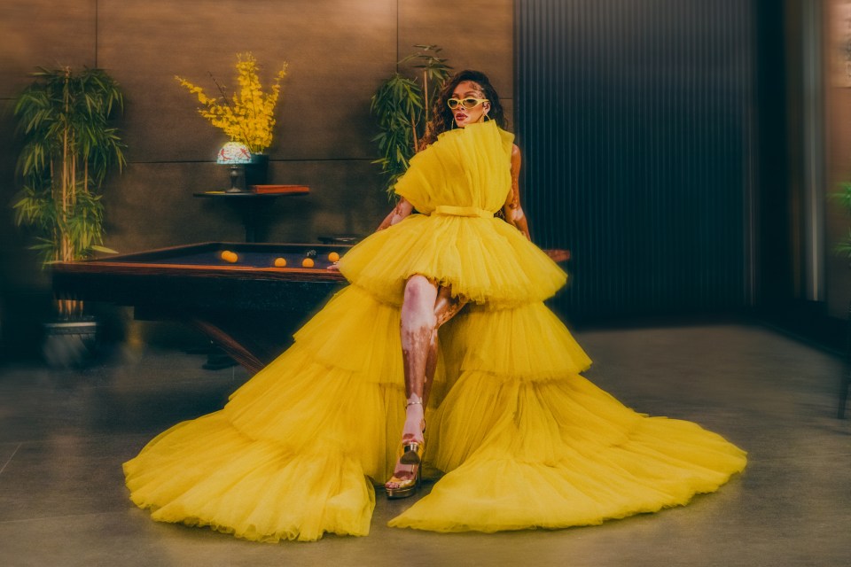 Winnie Harlow stunned in a yellow ball gown for Cîroc Vodka’s new campaign