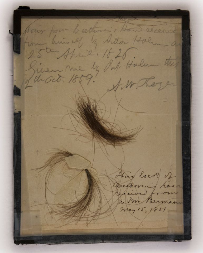 A new analysis of 200-year-old locks of the German composer’s hair reveal a high risk of liver disease was in his genes
