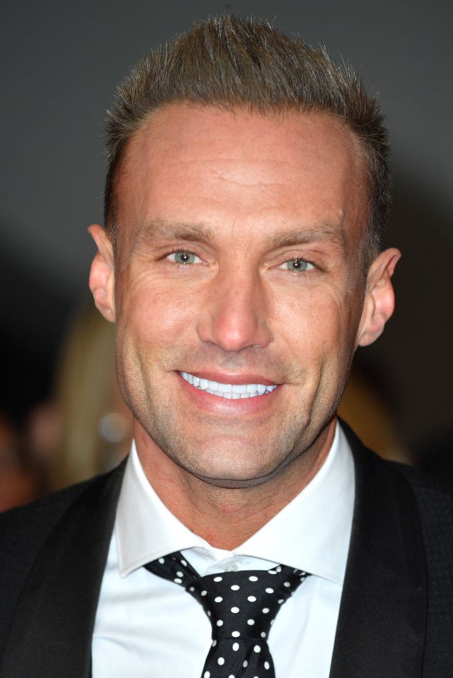 Celebrity SAS Who Dares Wins star Calum Best has had a SIXTH hair transplant