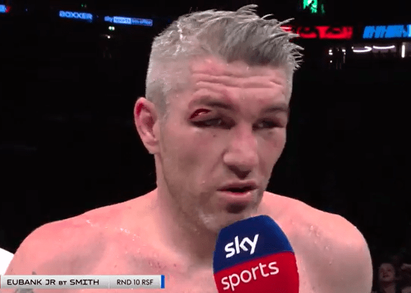A cut above the eye of Smith was visible during his post-fight interview