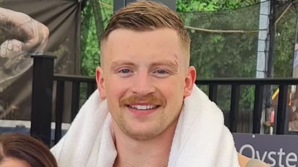 Pictures show Peaty with two gashes on his face following the fight, which left him with a bloody face