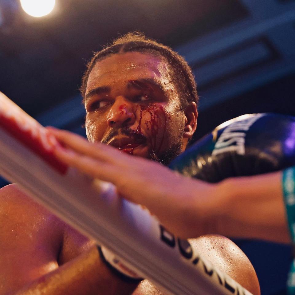 The Tottenham heavyweight's eyebrow exploded after being hit with a massive right hand