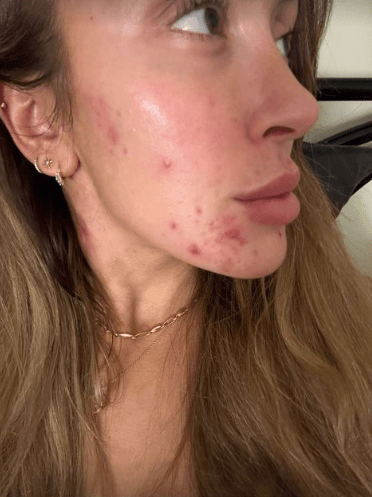Married At First Sight UK's Shona Manderson has shown off her 'real skin'