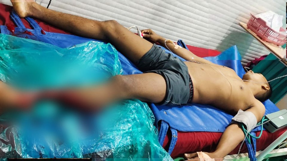 The victim had his leg chomped off and will need amputation